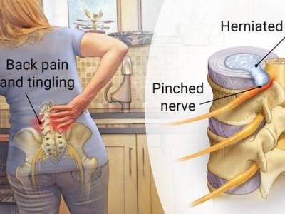 Advanced Pain Treatment – Guide For Pain Management &&nbsp;Therapy
